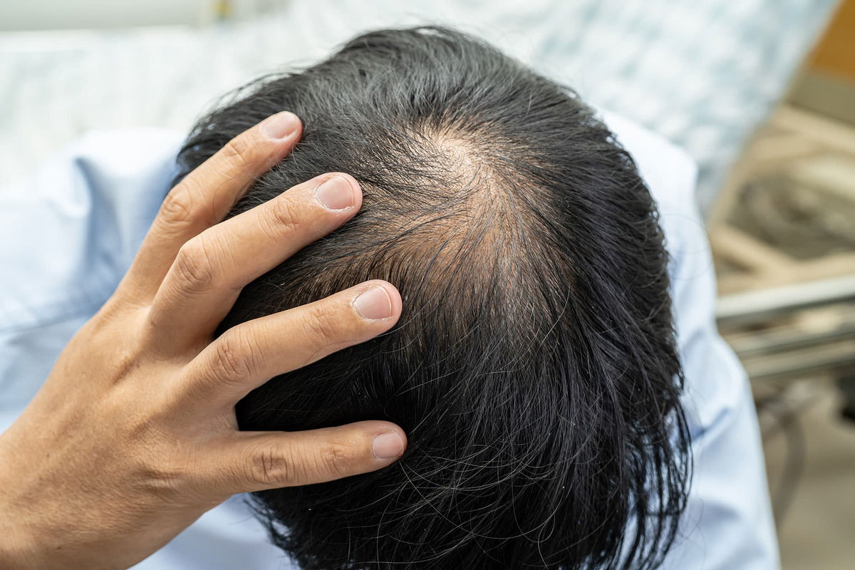 Vitamin D for Hair Regrowth: Does It Work?