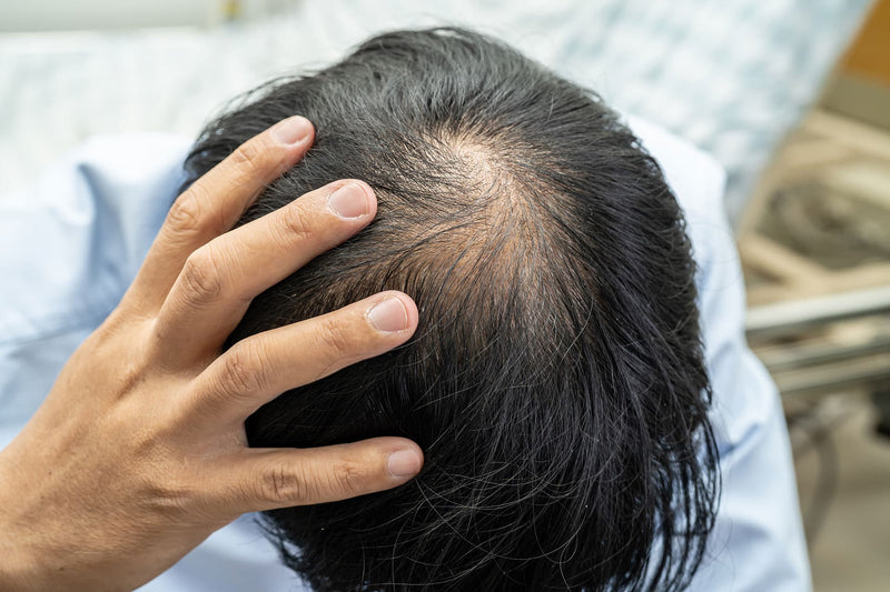 Vitamin D for Hair Regrowth: Does It Work?