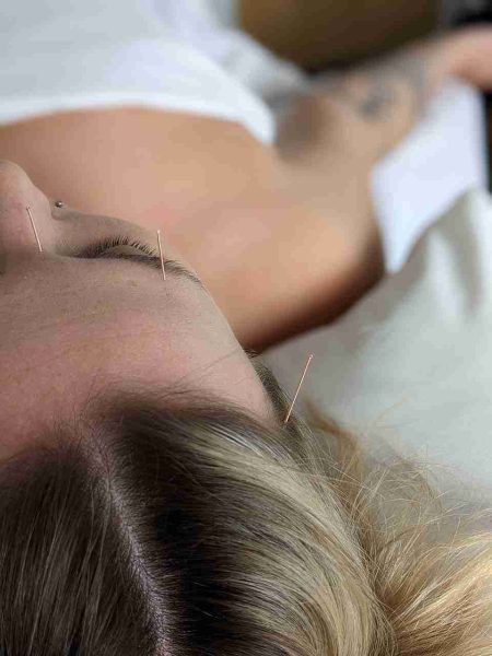 Facial rejuvenation acupuncture treatment